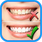 How to Whiten Teeth at home | Indus Appstore | App Icon