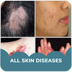 Skin diseases and treatment | Indus Appstore | App Icon