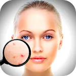 Face Enhancer: Blemish Remover | Indus Appstore | App Icon