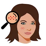 Acne Removal Tips Natural | Indus Appstore | App Icon