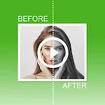 Diff before after video photo  | Indus Appstore | App Icon