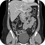 CT Abdomen Pelvis | Indus Appstore | App Icon