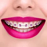 Braces Cameraapp icon