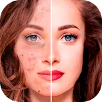 Blemishes Removal | Indus Appstore | App Icon