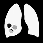 Lung Rads | Indus Appstore | App Icon