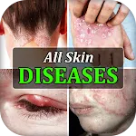 All Skin Diseases & Treatment | Indus Appstore | App Icon