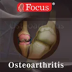 Osteoarthritis | Indus Appstore | App Icon