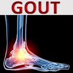 Arthritis Gout Uric Acid Diet | Indus Appstore | App Icon