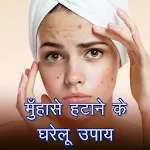 Acne and Pimples Home Remediesapp icon