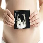 Ultrasound pregnancy guide | Indus Appstore | App Icon