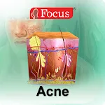 Acne | Indus Appstore | App Icon