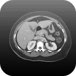 Radiology CT Viewer | Indus Appstore | App Icon