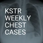 KSTR Weekly Chest Casesapp icon