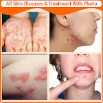 All Skin Diseases and Treatmenapp icon