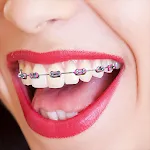 Braces Camera | Indus Appstore | App Icon