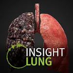 INSIGHT LUNG | Indus Appstore | App Icon