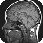 MRI Viewerapp icon