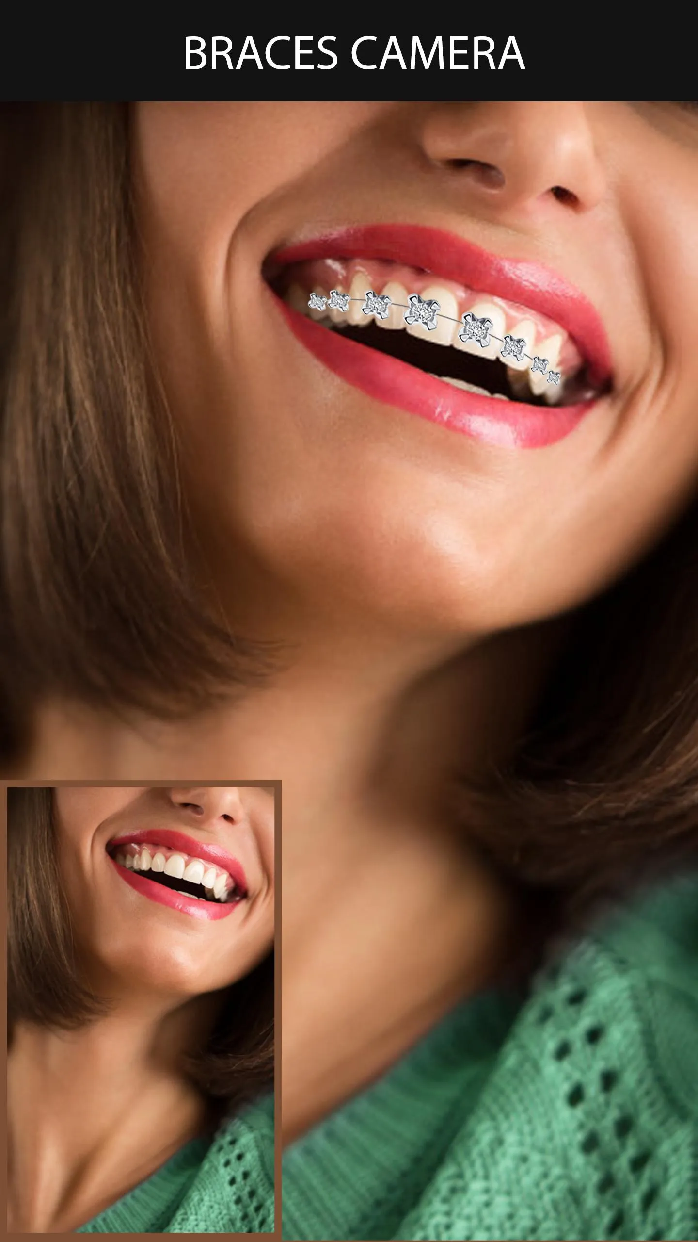 Braces Camera | Indus Appstore | Screenshot