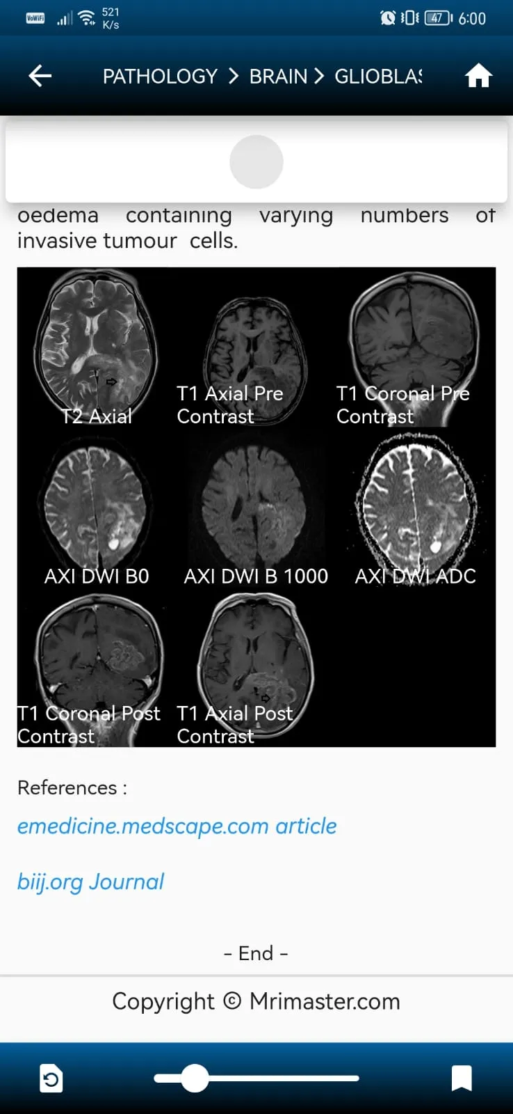 MRI MASTER | Indus Appstore | Screenshot