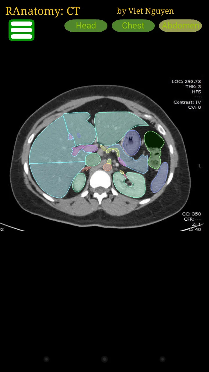 Radiology CT Anatomy | Indus Appstore | Screenshot