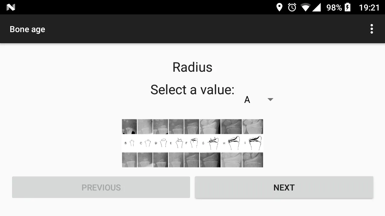 Bone age | Indus Appstore | Screenshot