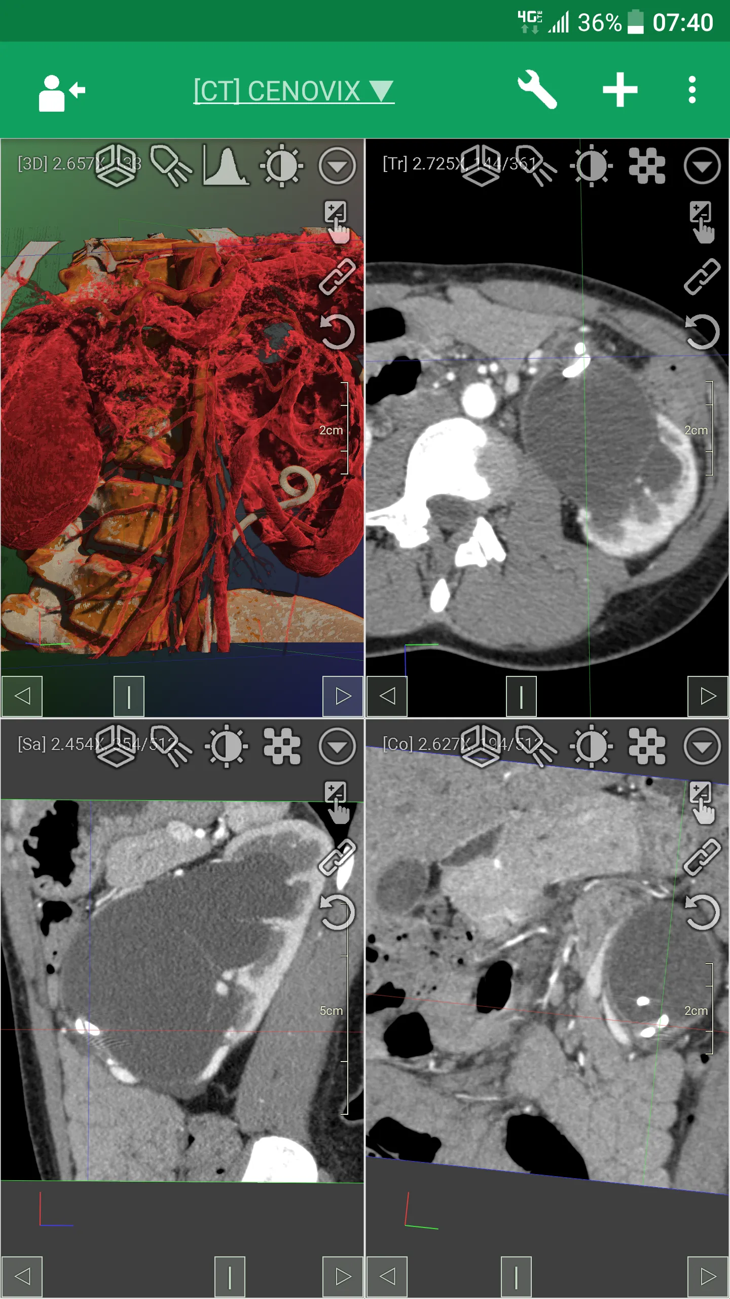 DroidRender - 3D DICOM viewer | Indus Appstore | Screenshot