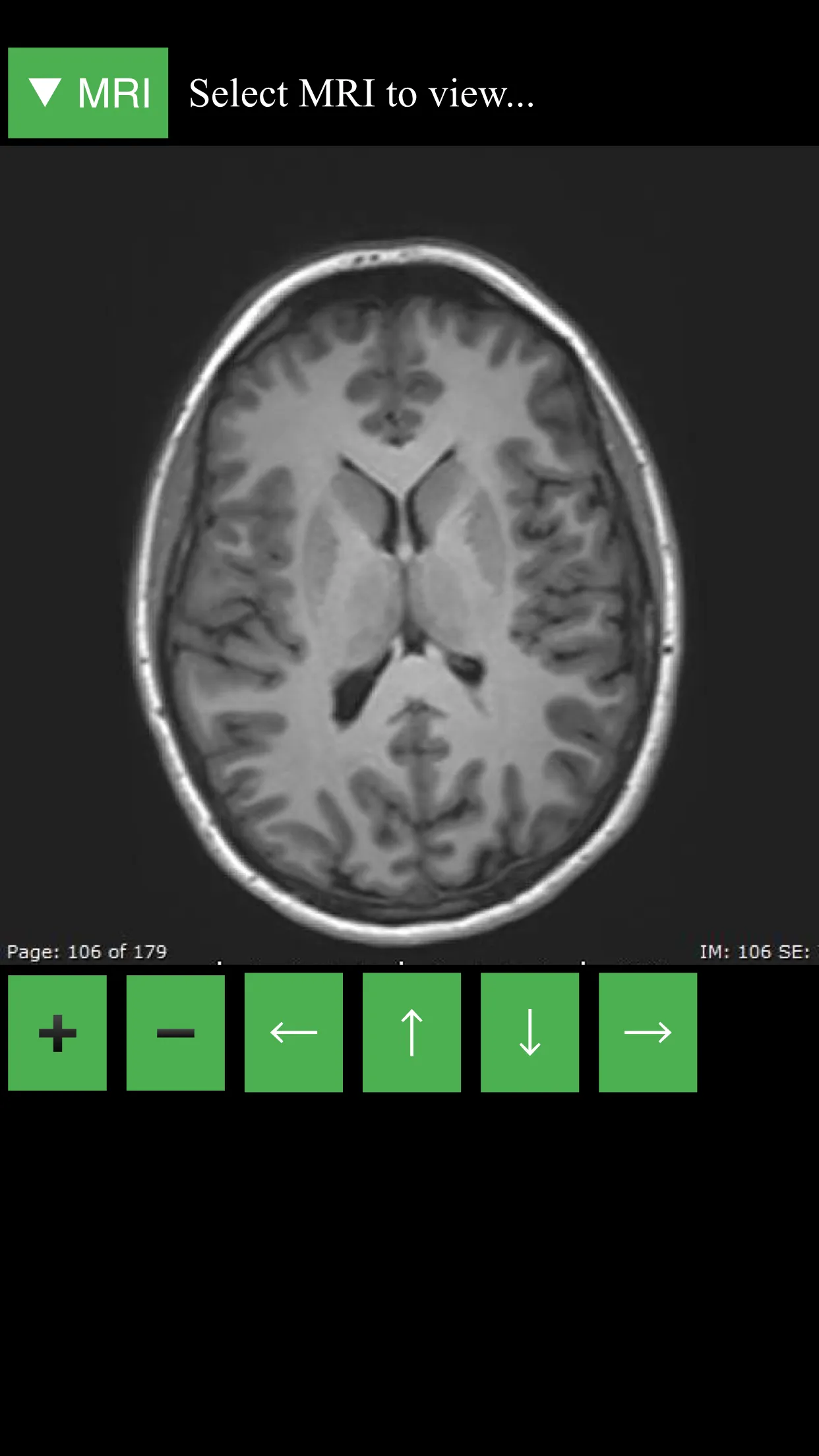 MRI Viewer | Indus Appstore | Screenshot