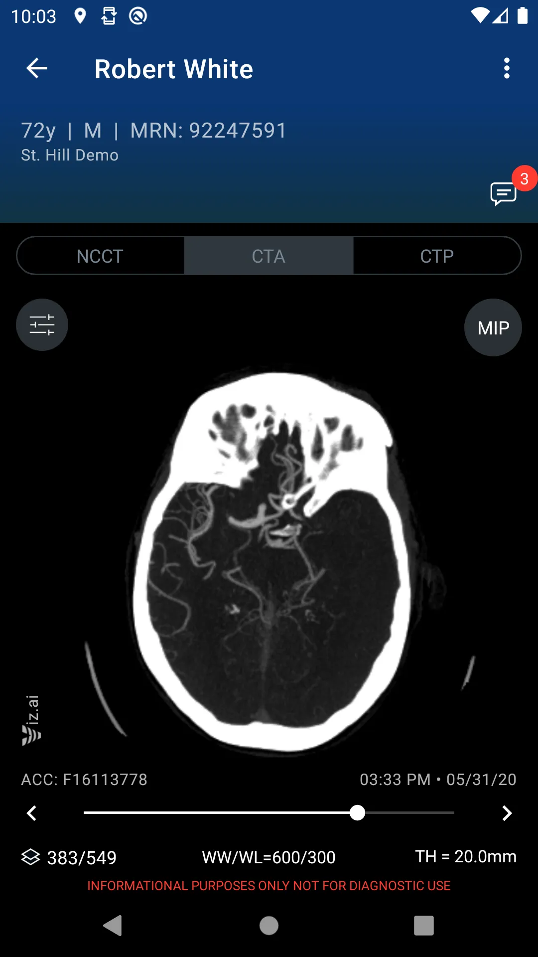 Viz.ai | Indus Appstore | Screenshot