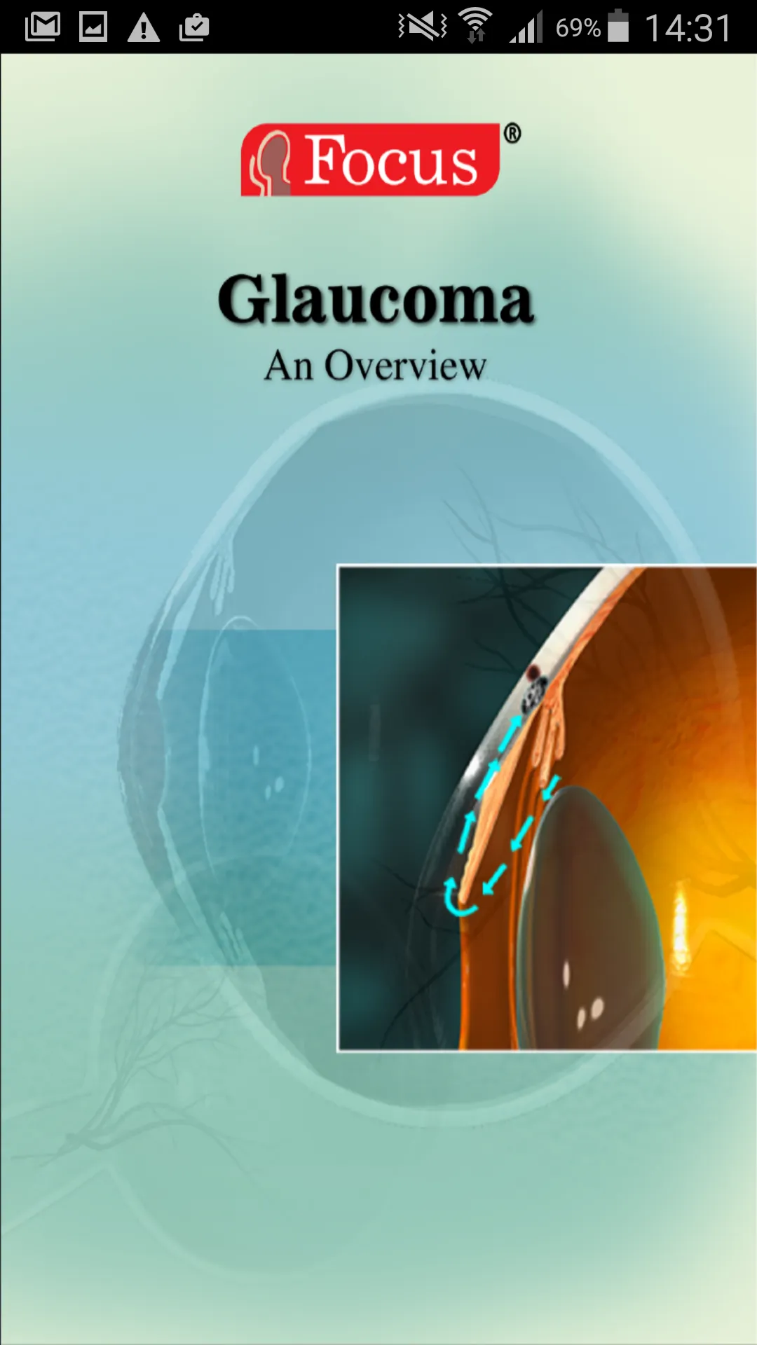 Glaucoma (An Overview) | Indus Appstore | Screenshot