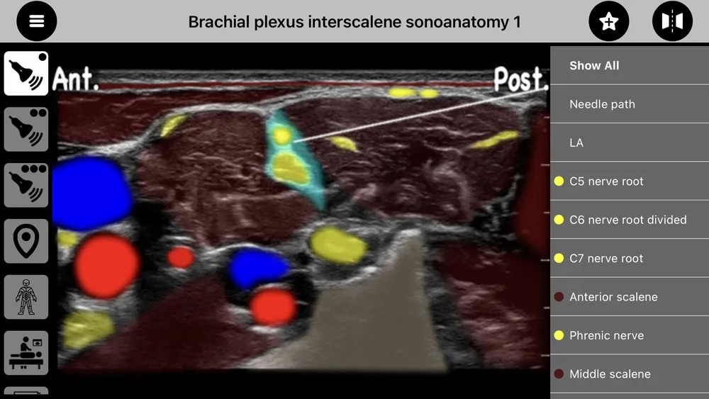 AnSo Anaesthesia Sonoanatomy | Indus Appstore | Screenshot