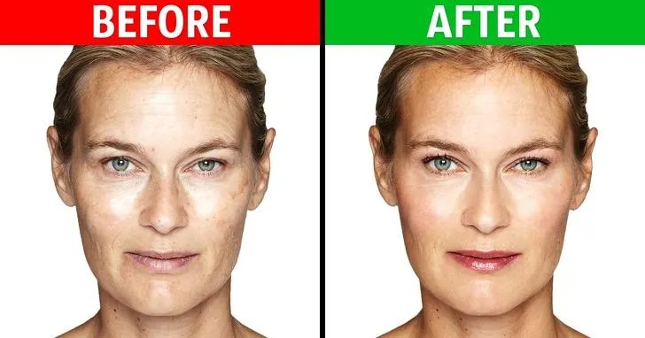 Wrinkles Removal Exercises | Indus Appstore | Screenshot