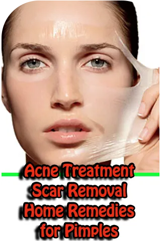 Remedies for Pimples, Acne Tre | Indus Appstore | Screenshot