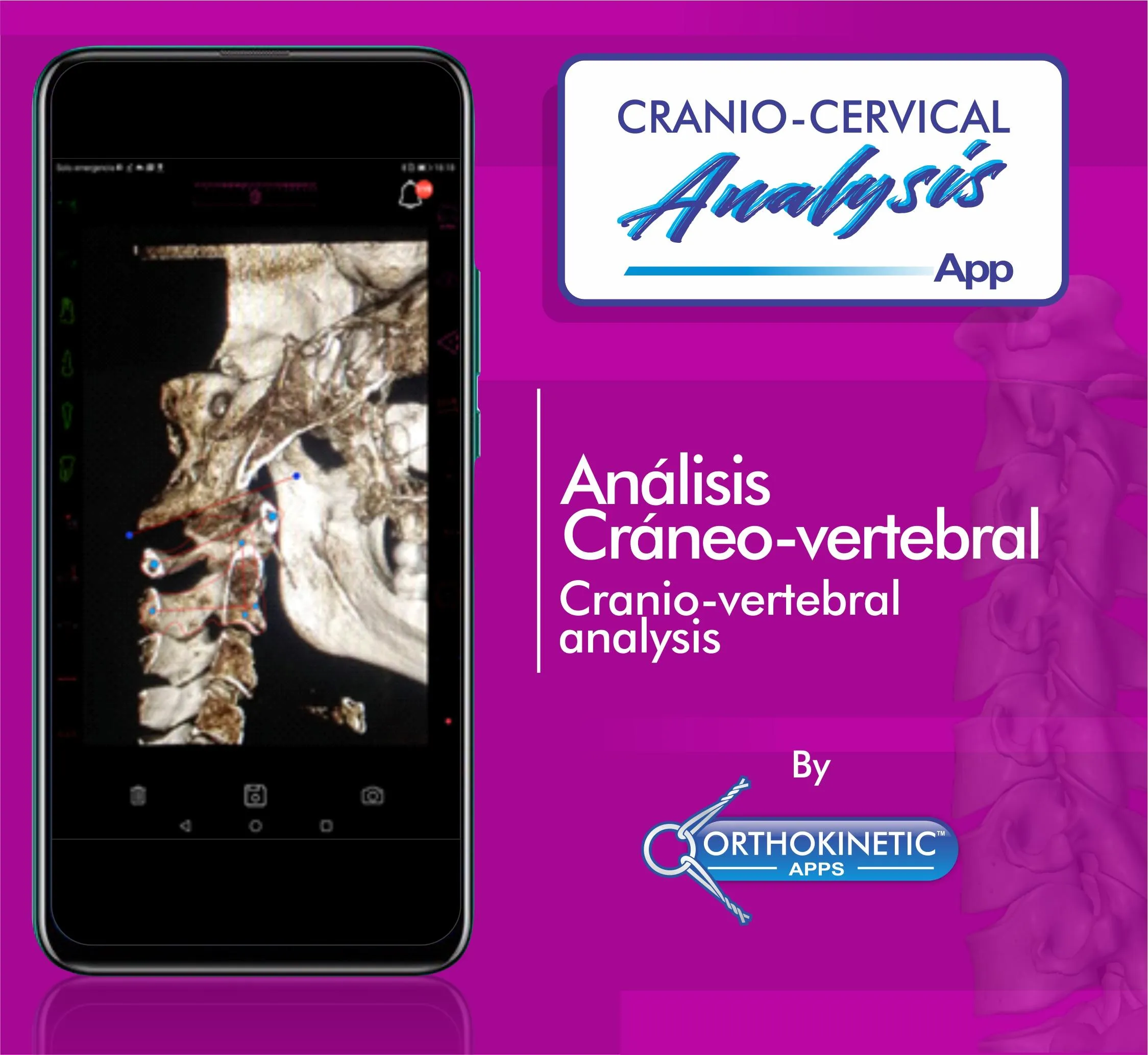 Cranio-cervical Analysis by Or | Indus Appstore | Screenshot