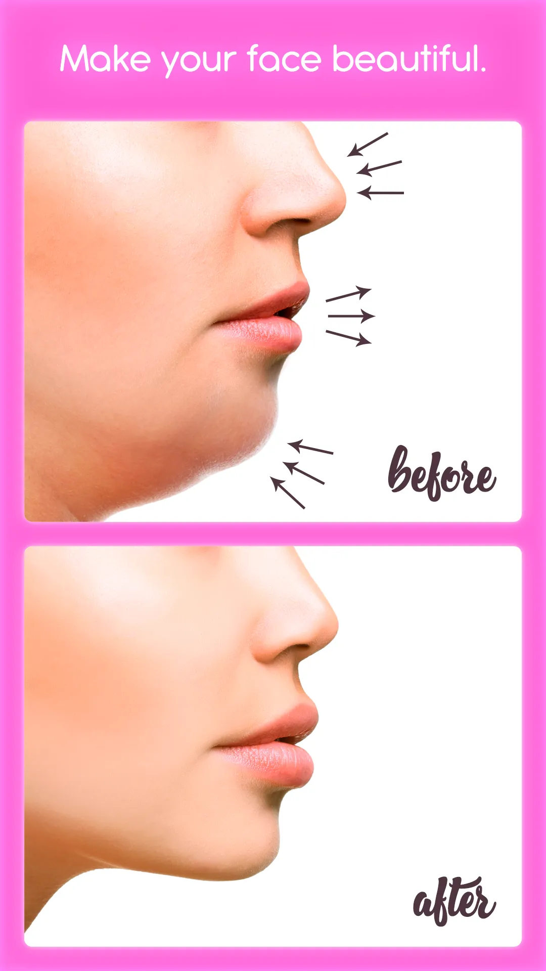 Rhinoplasty | Indus Appstore | Screenshot