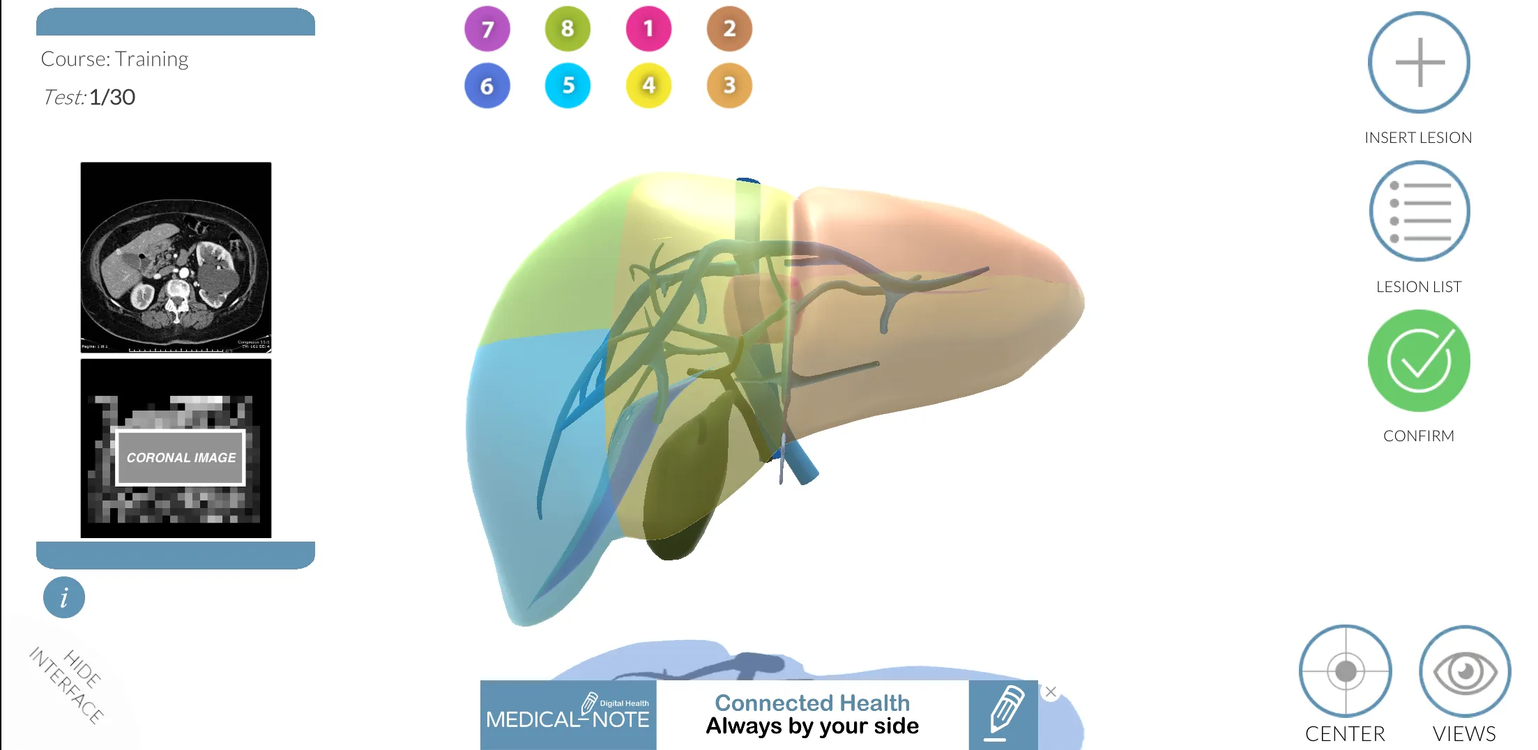 LIVER-NOTE.Edu | Indus Appstore | Screenshot