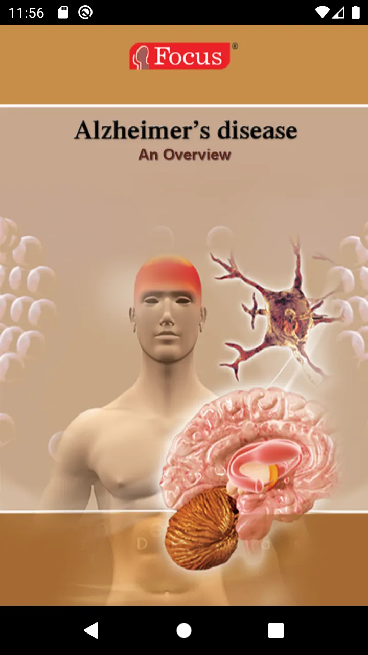 Alzheimer Disease | Indus Appstore | Screenshot