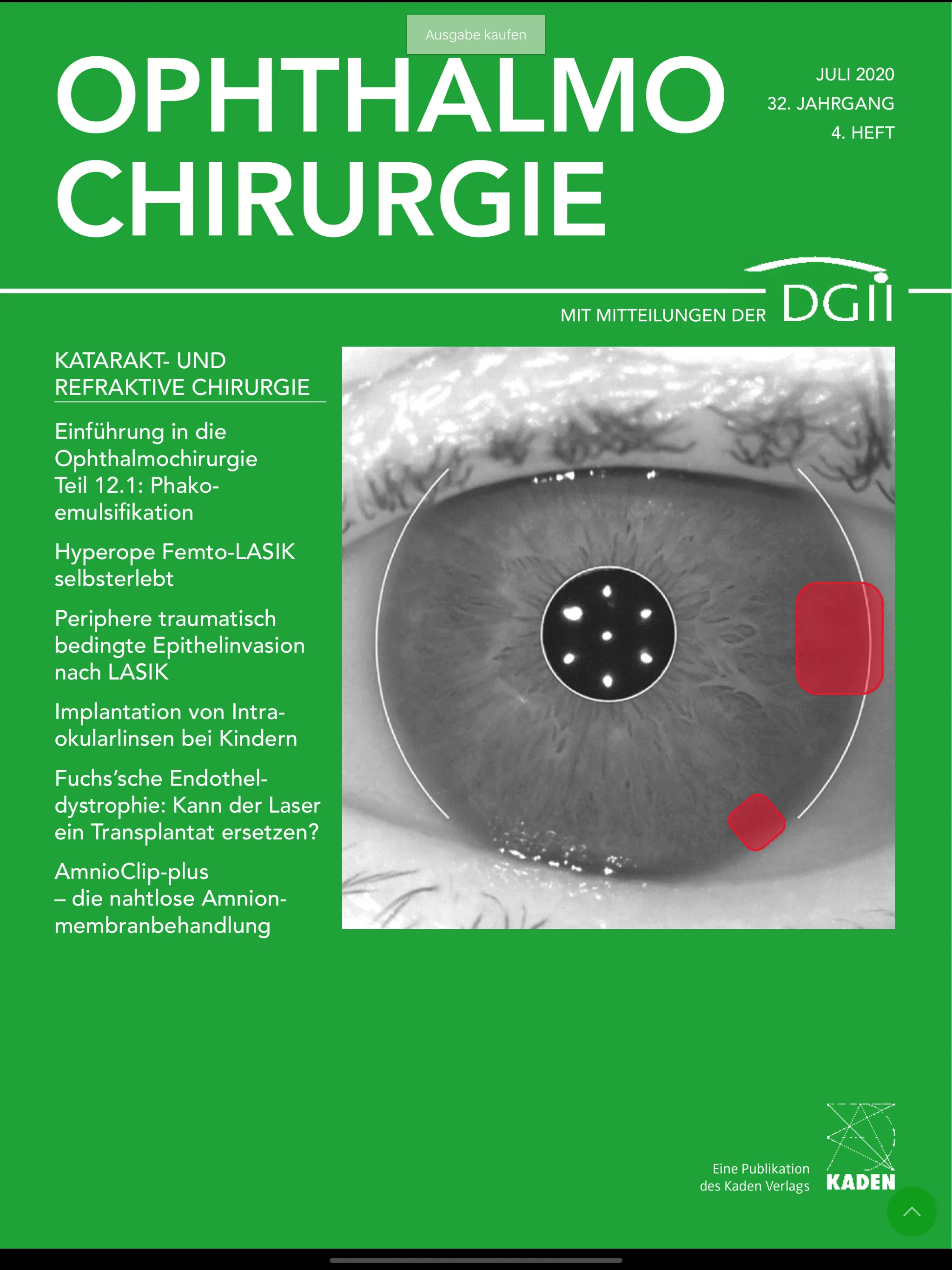 OPHTHALMO-CHIRURGIE – OC App | Indus Appstore | Screenshot