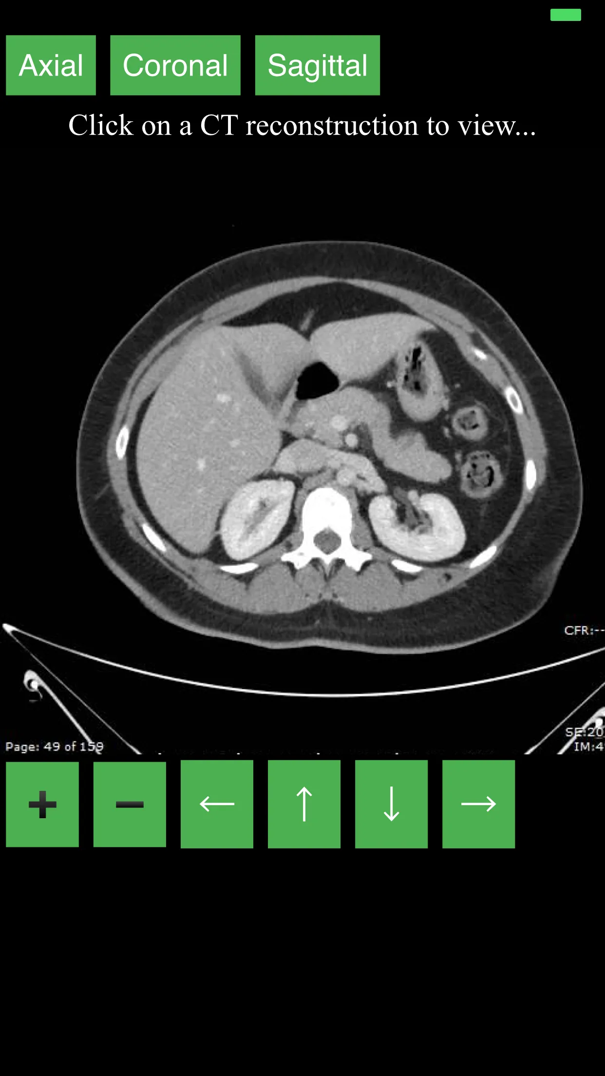 CT Abdomen Pelvis | Indus Appstore | Screenshot