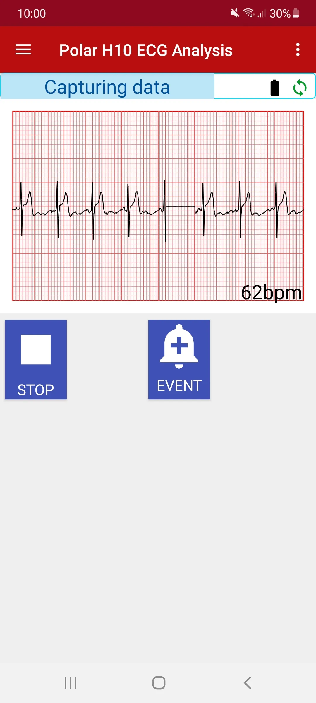 ECG Analysis for Polar H10 | Indus Appstore | Screenshot