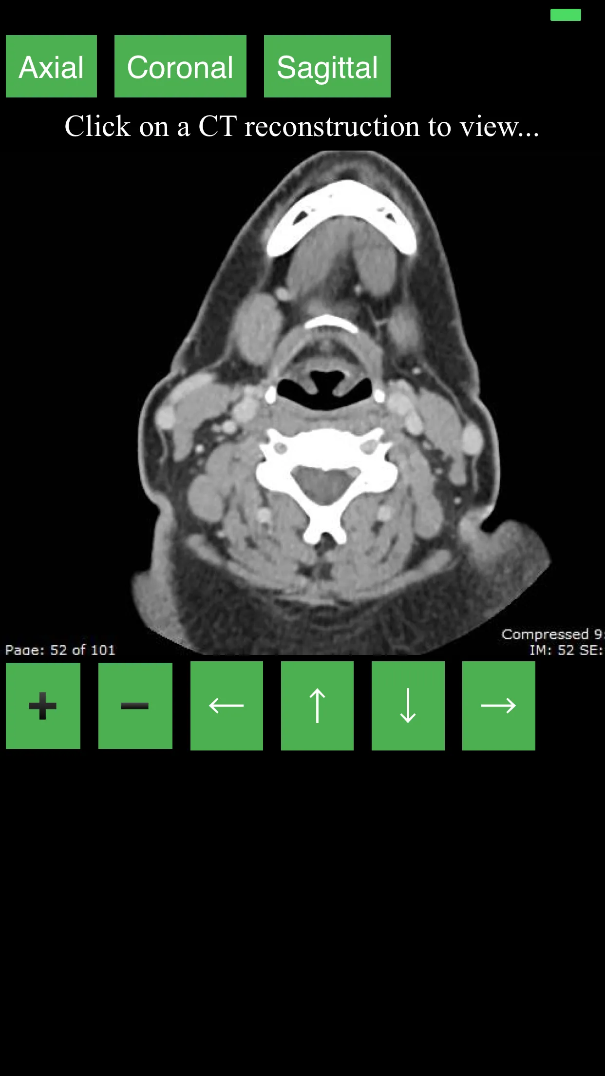 CT Neck | Indus Appstore | Screenshot