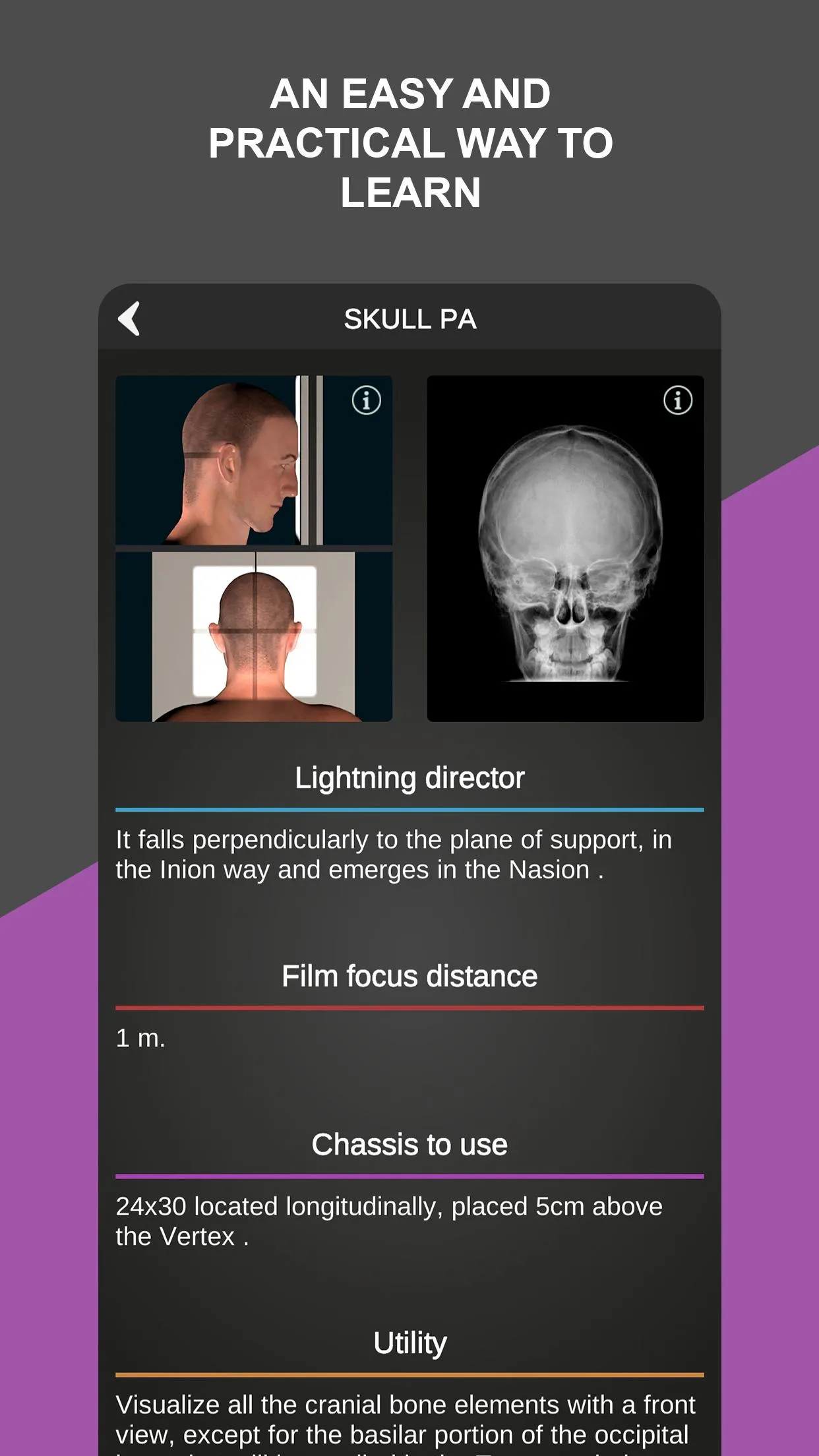 RX - Radiographic Positioning | Indus Appstore | Screenshot