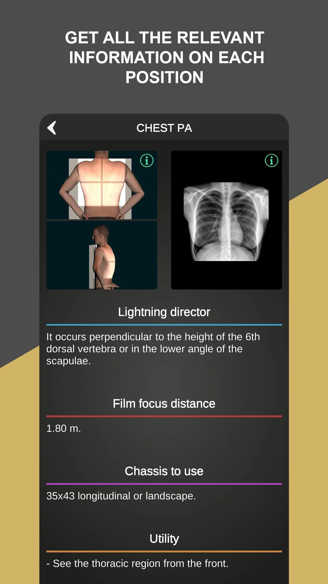 RX - Radiographic Positioning | Indus Appstore | Screenshot