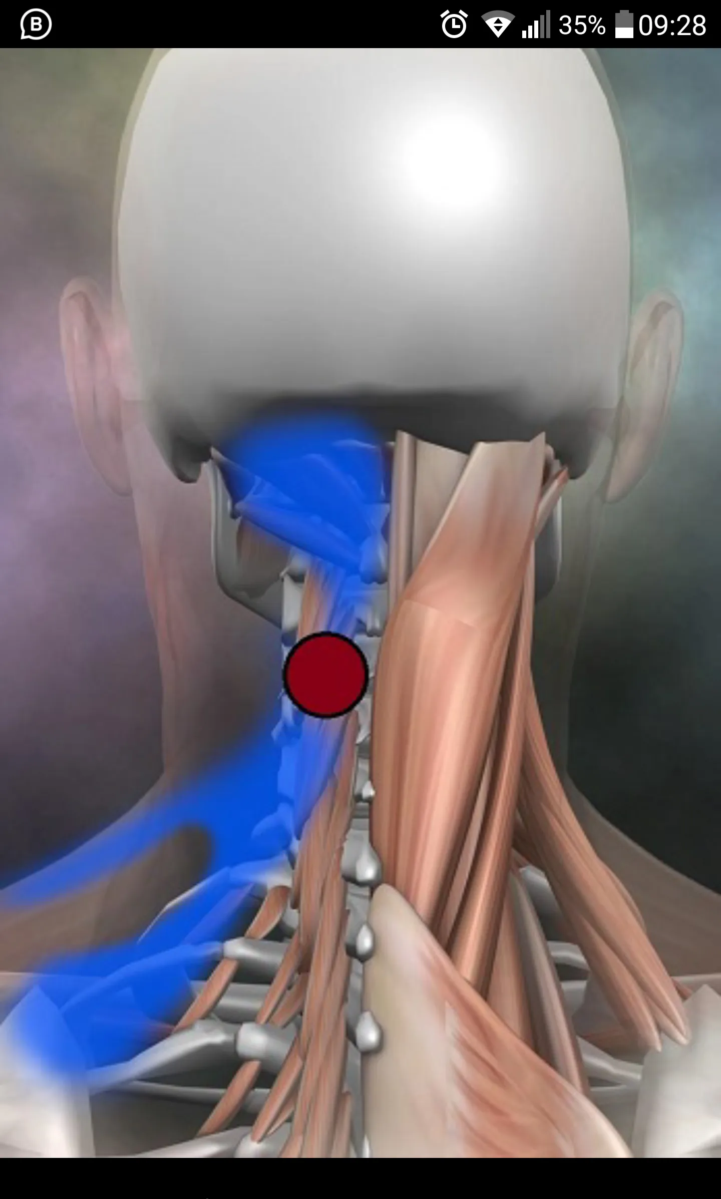 Trigger Points | Indus Appstore | Screenshot