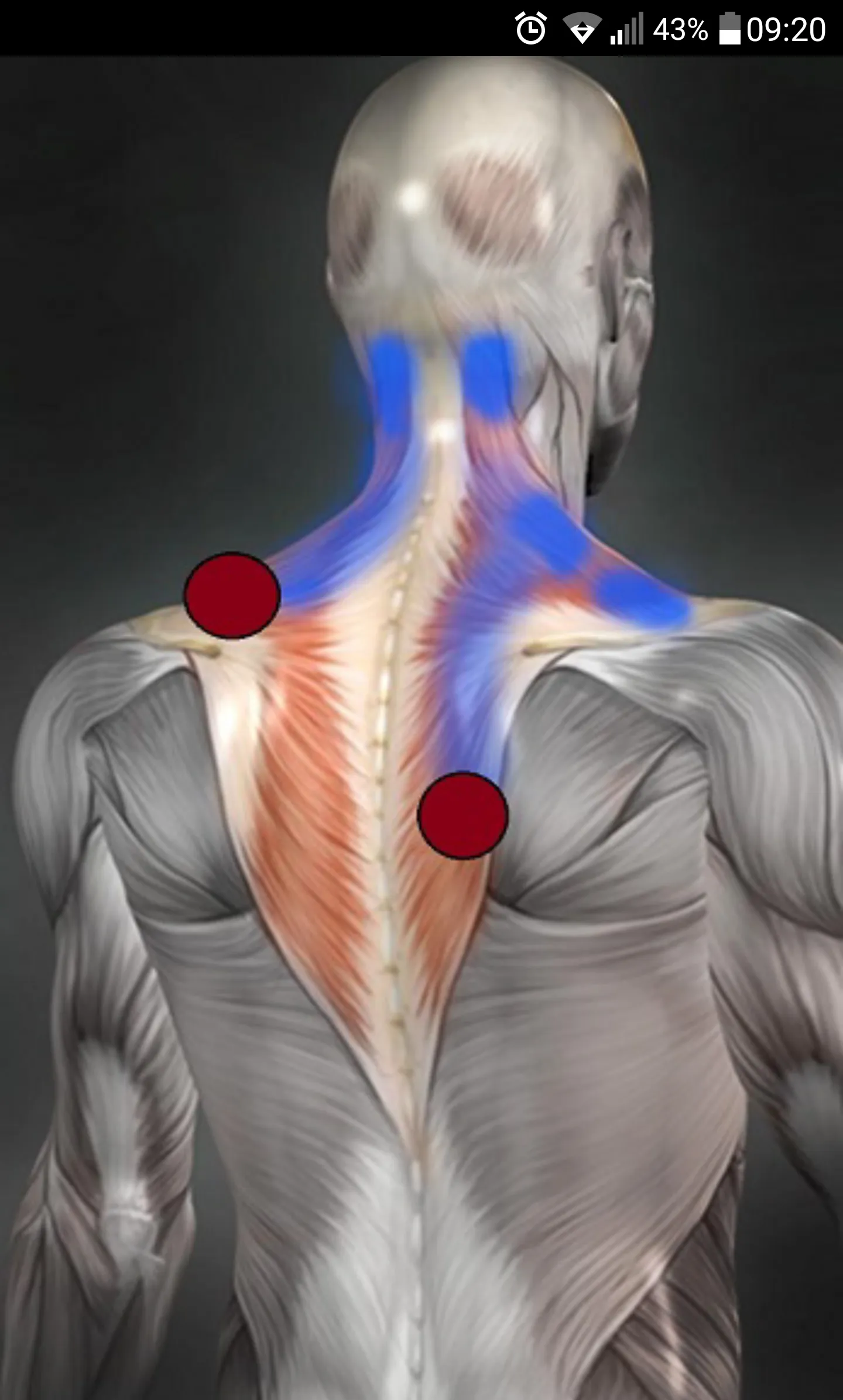 Trigger Points | Indus Appstore | Screenshot