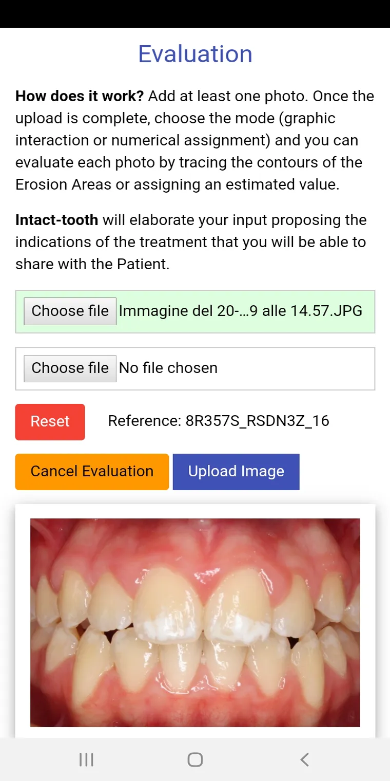 Intact-tooth | Indus Appstore | Screenshot