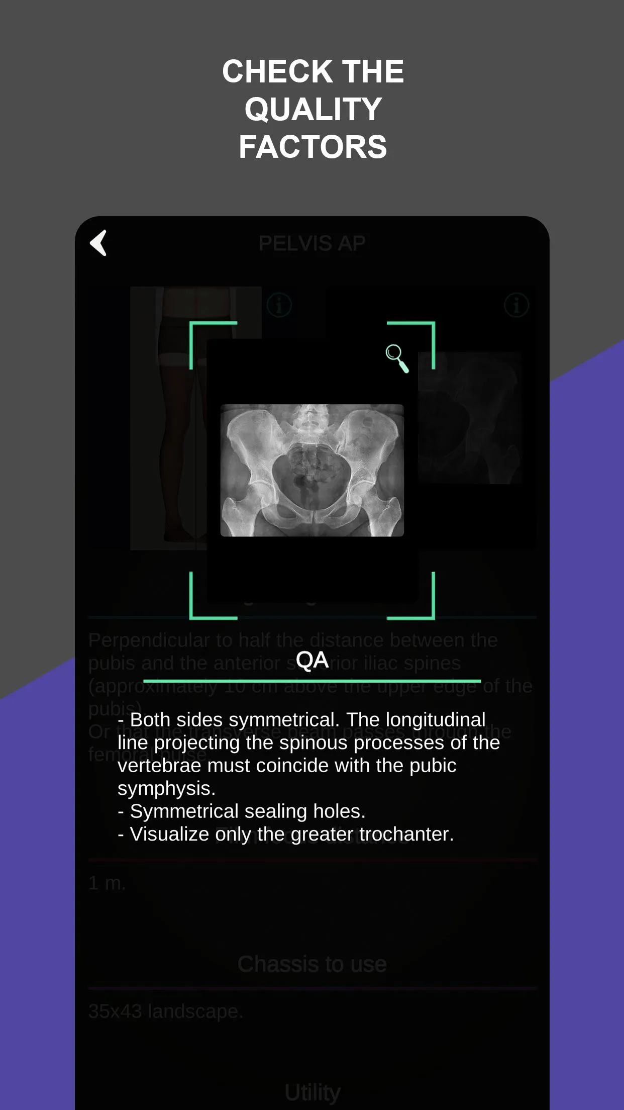 RX - Radiographic Positioning | Indus Appstore | Screenshot