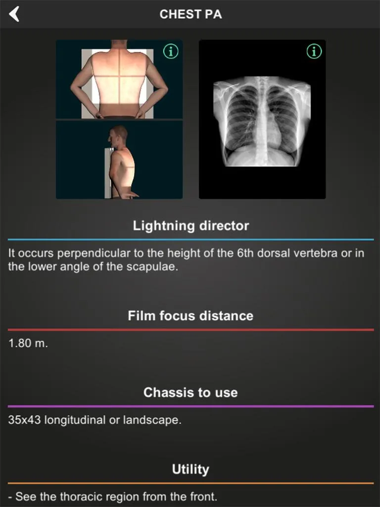 RX - Radiographic Positioning | Indus Appstore | Screenshot