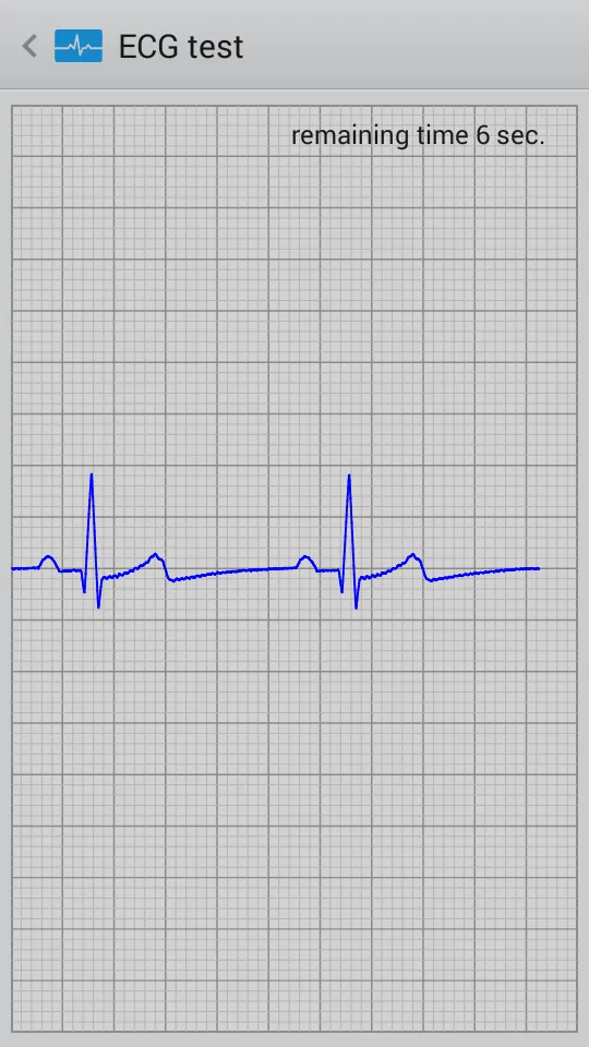 Istel ECG | Indus Appstore | Screenshot