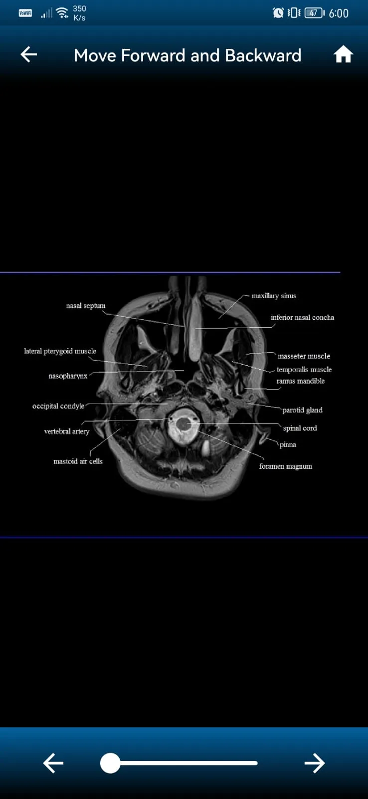 MRI MASTER | Indus Appstore | Screenshot