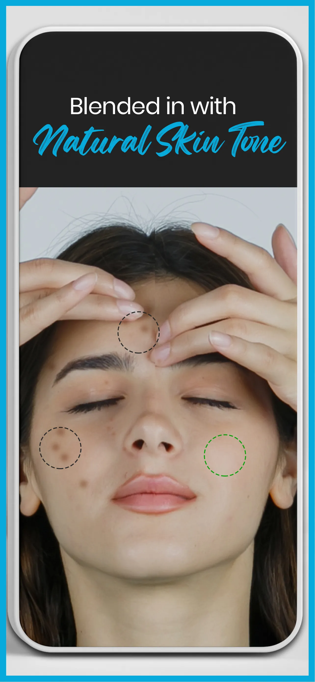 Pimple remover - Acne eraser | Indus Appstore | Screenshot